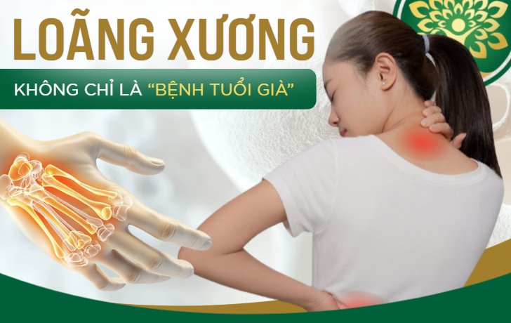 Loãng xương - không chỉ là bệnh tuổi già